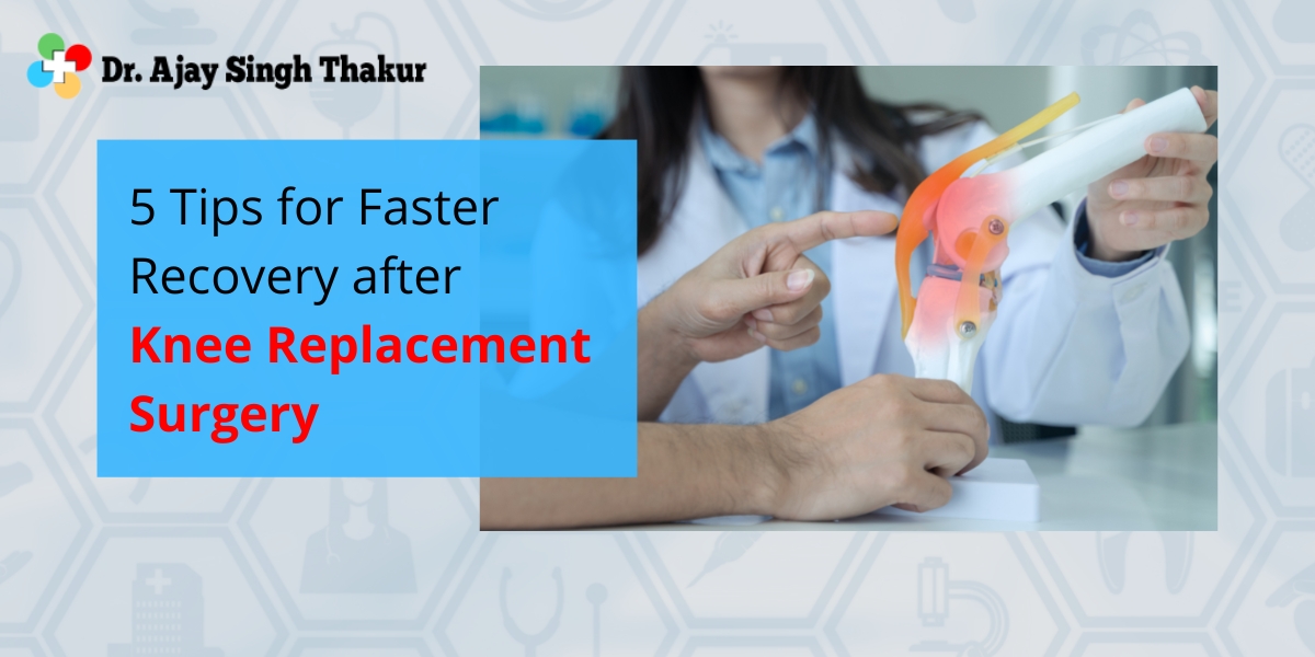 5 Tips for Faster Recovery after Knee Replacement Surgery Dr. Ajay Singh Thakur